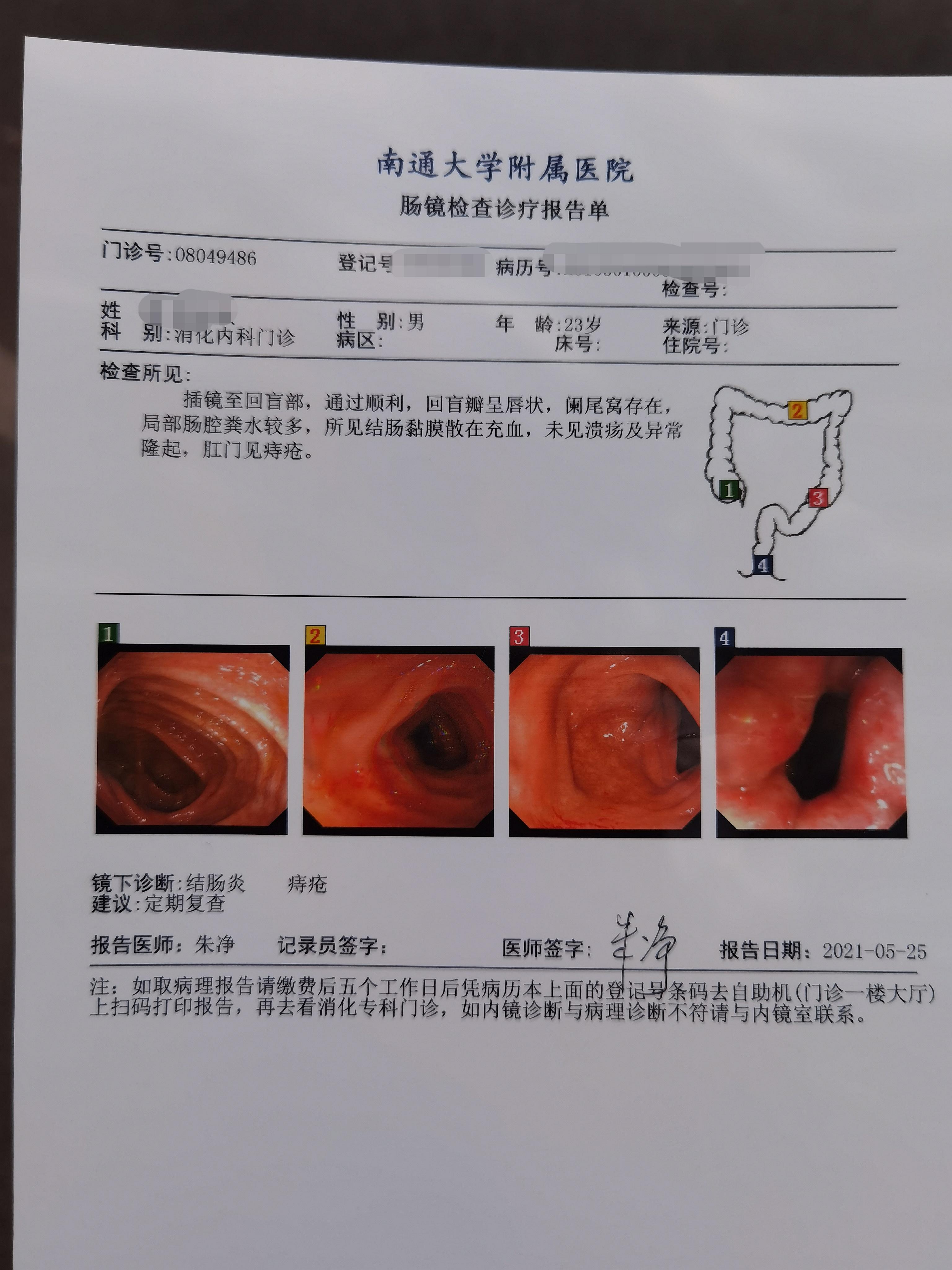 做的肠镜我应该吃哪些药